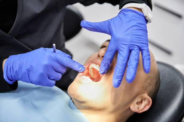 Best Urgent Care for Lost Fillings or Crowns in Old Tappan, NJ